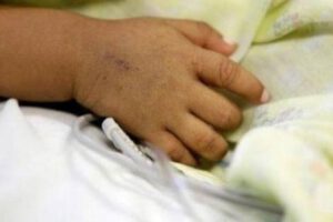 Curandero provoca intoxicación fatal en niño de dos años