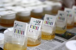 Color amarillo de la orina y su causa descubierta por científicos