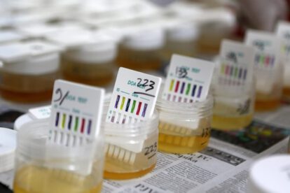Color amarillo de la orina y su causa descubierta por científicos