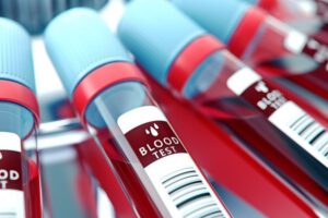 Análisis de sangre Alzheimer