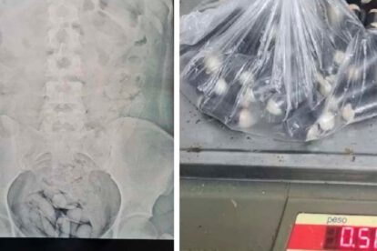 Ciudadana boliviana con cápsulas de droga