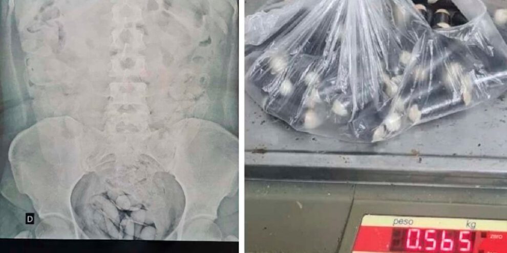 Ciudadana boliviana con cápsulas de droga