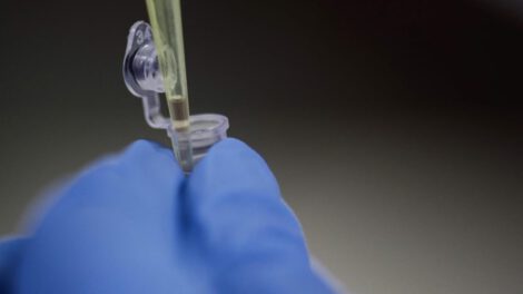 Nuevo anticuerpo SARS-CoV-2 bloquea variantes incluyendo ómicron