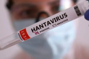 hantavirus