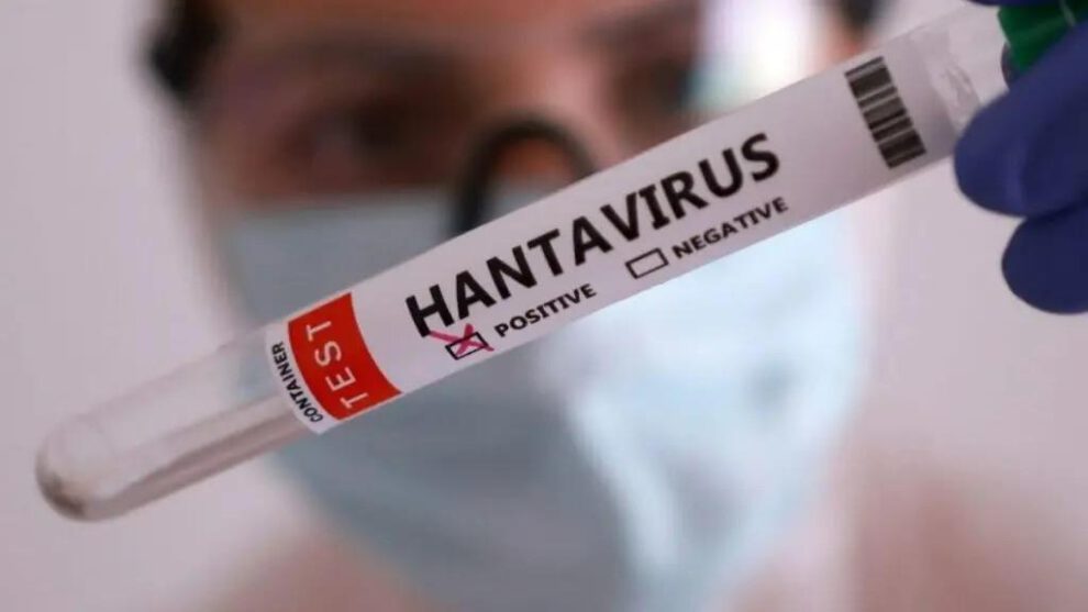hantavirus