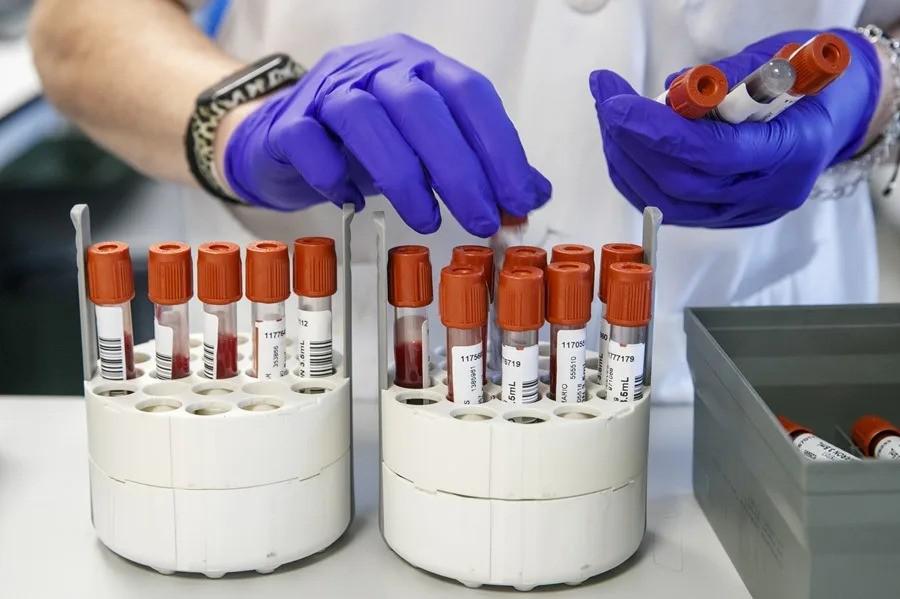 Personal técnico de laboratorio prepara unas muestras para analizar
