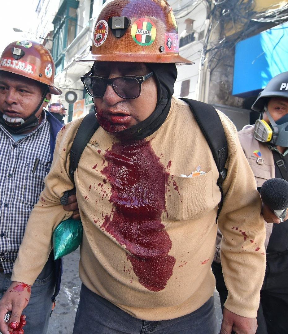Un minero herido es retirado de la escena por otros manifestantes