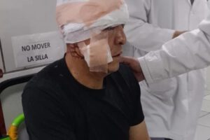 El suboficial fue intervenido quirúrgicamente debido a una grave lesión ocular