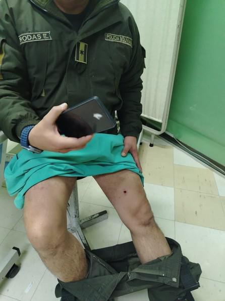 Los enfrentamientos también dejaron un saldo de once policías heridos