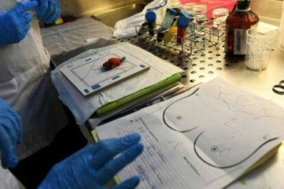 Desodorantes y cáncer de mama