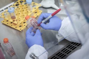 La variante AY.4.2 del coronavirus podría ser más contagiosa que la Delta