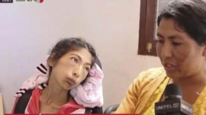 Carmen Vargas, la joven de 19 años que quedó parapléjica por una picadura de viuda negra