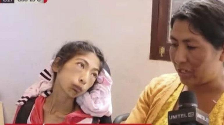 Carmen Vargas, la joven de 19 años que quedó parapléjica por una picadura de viuda negra