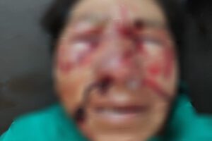 Ataque de perros en Huanuni