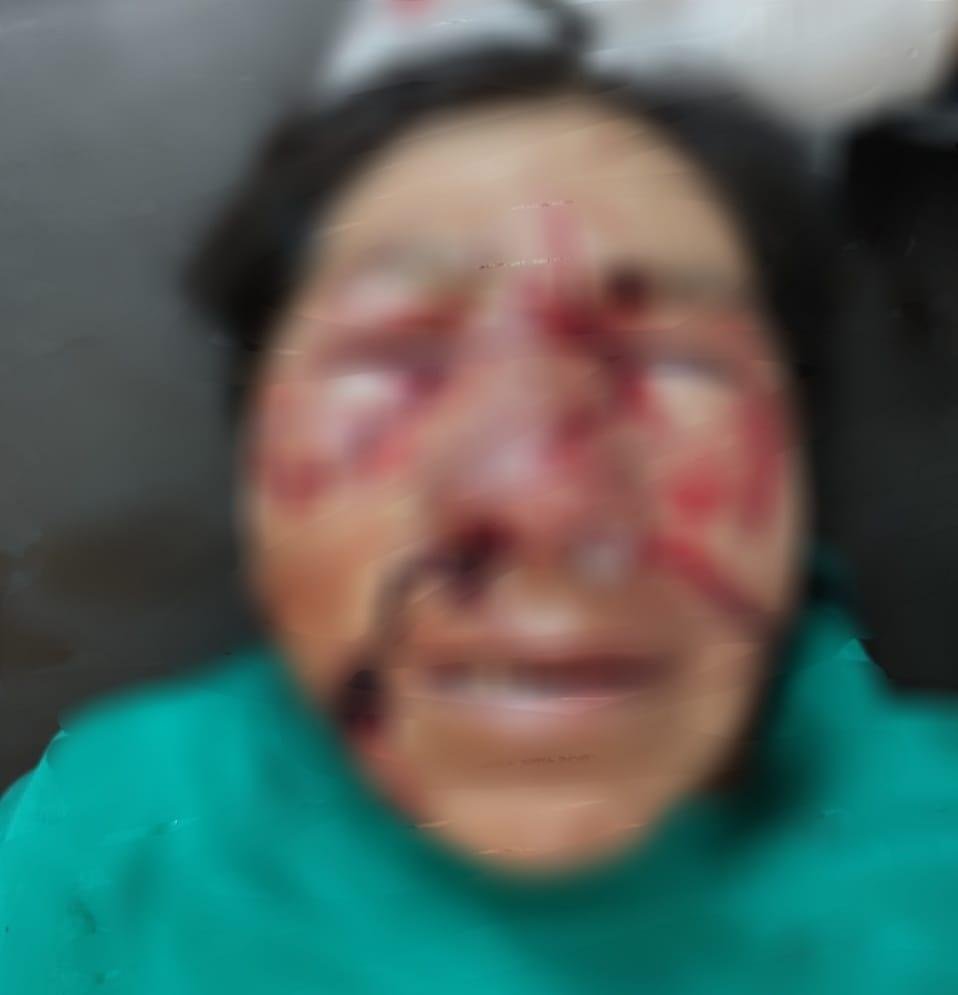 Ataque de perros en Huanuni