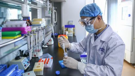 Covid-19 persiste en órganos del cuerpo