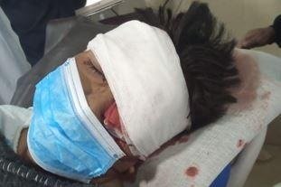 Joven perdió el ojo izquierdo tras ser atacado con un objeto punzocortante