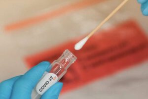 Controles de costo para pruebas PCR de Covid-19