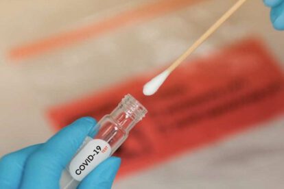 Controles de costo para pruebas PCR de Covid-19