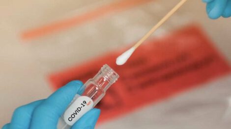 Controles de costo para pruebas PCR de Covid-19