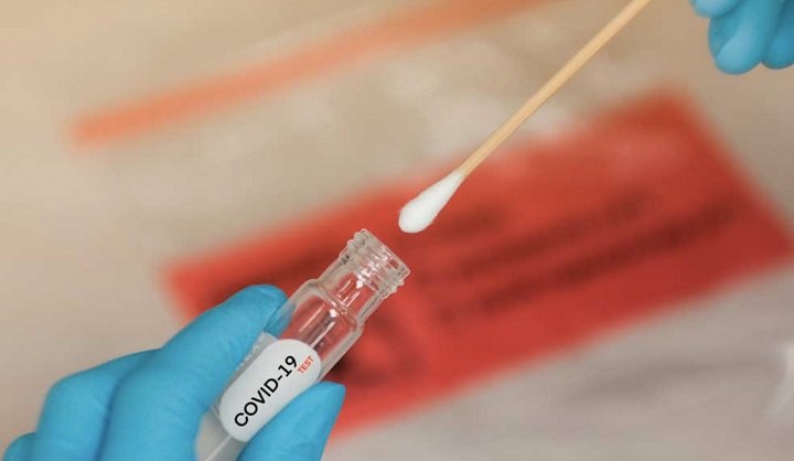 Controles de costo para pruebas PCR de Covid-19