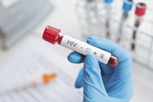 Descubren nueva variante más virulenta y transmisible del VIH