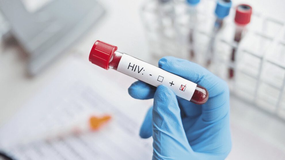 Descubren nueva variante más virulenta y transmisible del VIH