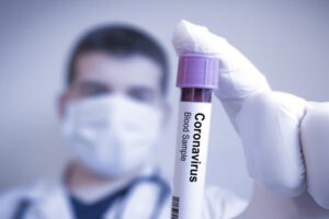 Prueba negativa coronavirus Sucre