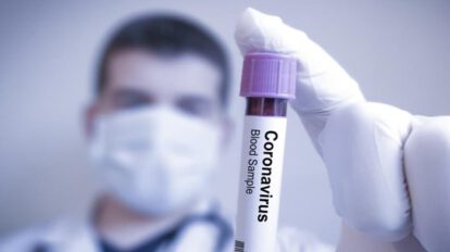 Prueba negativa coronavirus Sucre