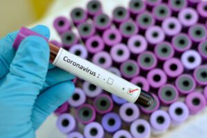 monitoreo de coronavirus en Oruro