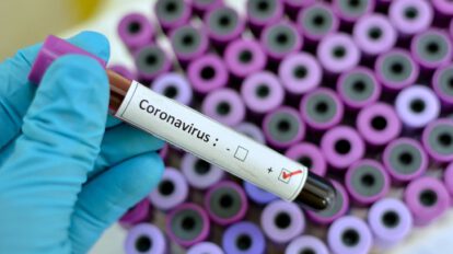 monitoreo de coronavirus en Oruro