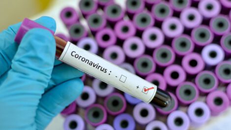 monitoreo de coronavirus en Oruro