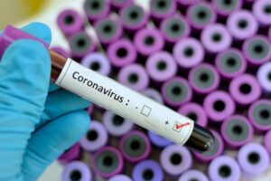 Caso sospechoso de coronavirus en Beni