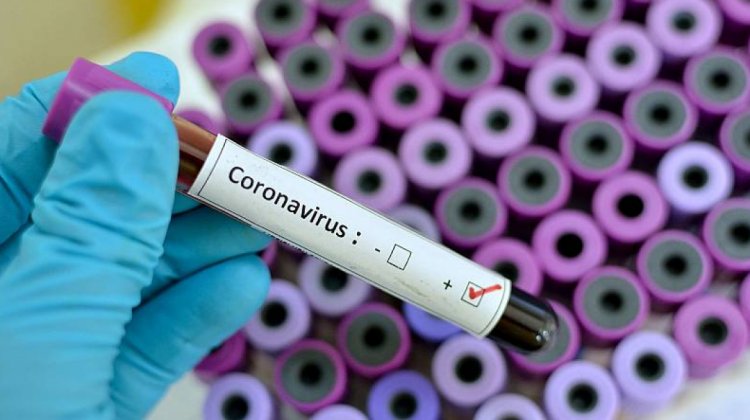 Caso sospechoso de coronavirus en Beni