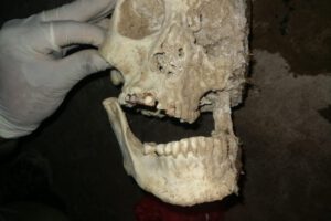 Restos óseos de mujer en Oruro con dientes de oro