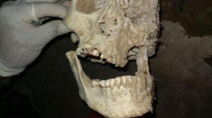 Restos óseos de mujer en Oruro con dientes de oro