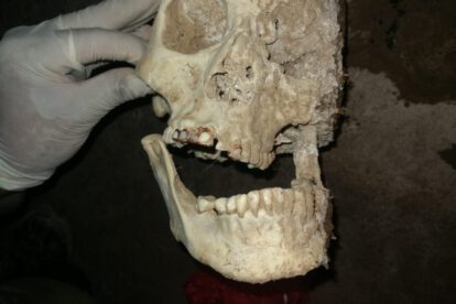 Restos óseos de mujer en Oruro con dientes de oro
