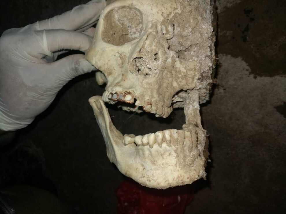 Restos óseos de mujer en Oruro con dientes de oro