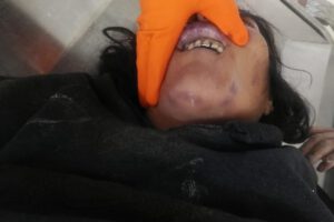 Mujer fue asfixiada en Oruro