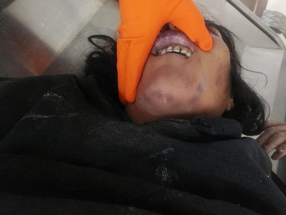 Mujer fue asfixiada en Oruro
