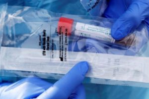 Covid-19 en Oruro: escasez de reactivos y llegada del laboratorio