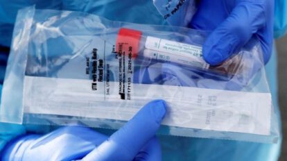 Covid-19 en Oruro: escasez de reactivos y llegada del laboratorio