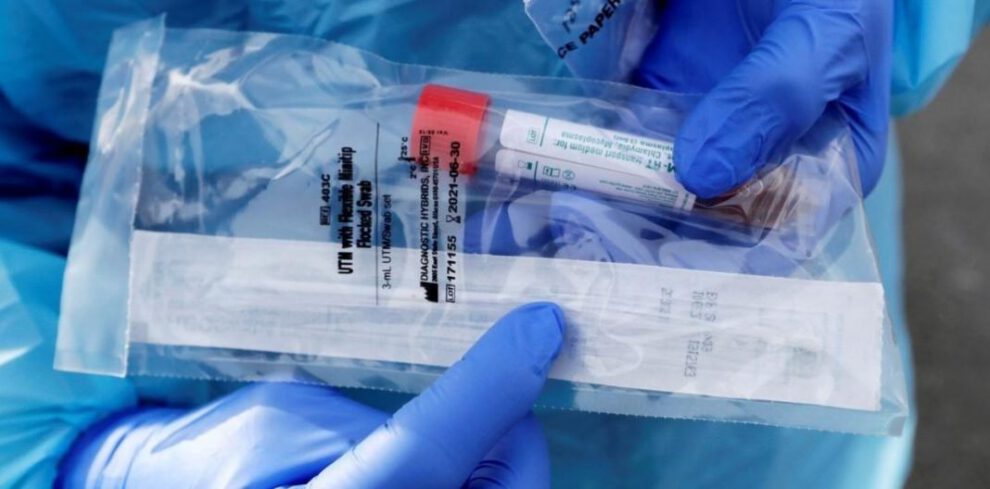 Covid-19 en Oruro: escasez de reactivos y llegada del laboratorio