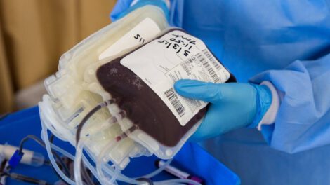 Paciente Covid-19 mejora gracias al tratamiento con plasma hiperinmune