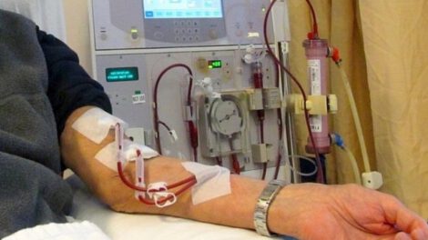 Campaña gratuita de implantación quirúrgica de fístula en pacientes renales