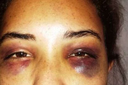 Mujer agredida en Santa Cruz logra huir de su agresor