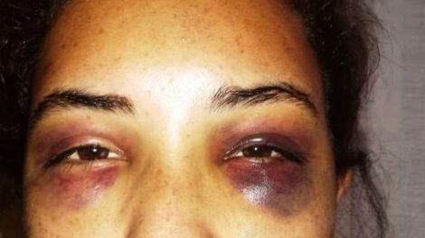 Mujer agredida en Santa Cruz logra huir de su agresor