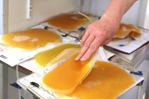 Donación de plasma hiperinmune para el tratamiento de pacientes con Covid-19