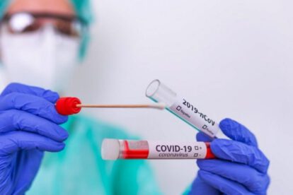 Covid-19 en Santa Cruz: falta de insumos en laboratorios