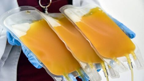 Uso de plasma sanguíneo hiperinmune para pacientes Covid-19